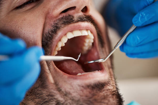 Best Emergency Treatment for Dental Infections or Abscesses in Villisca, IA