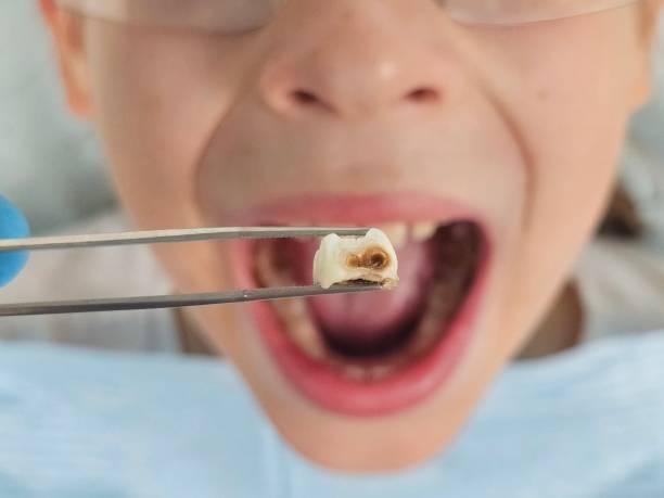 Best Pediatric Emergency Dentist in Villisca, IA